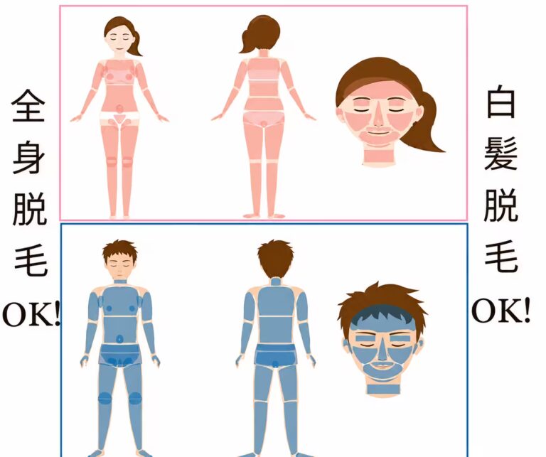 全身脱毛